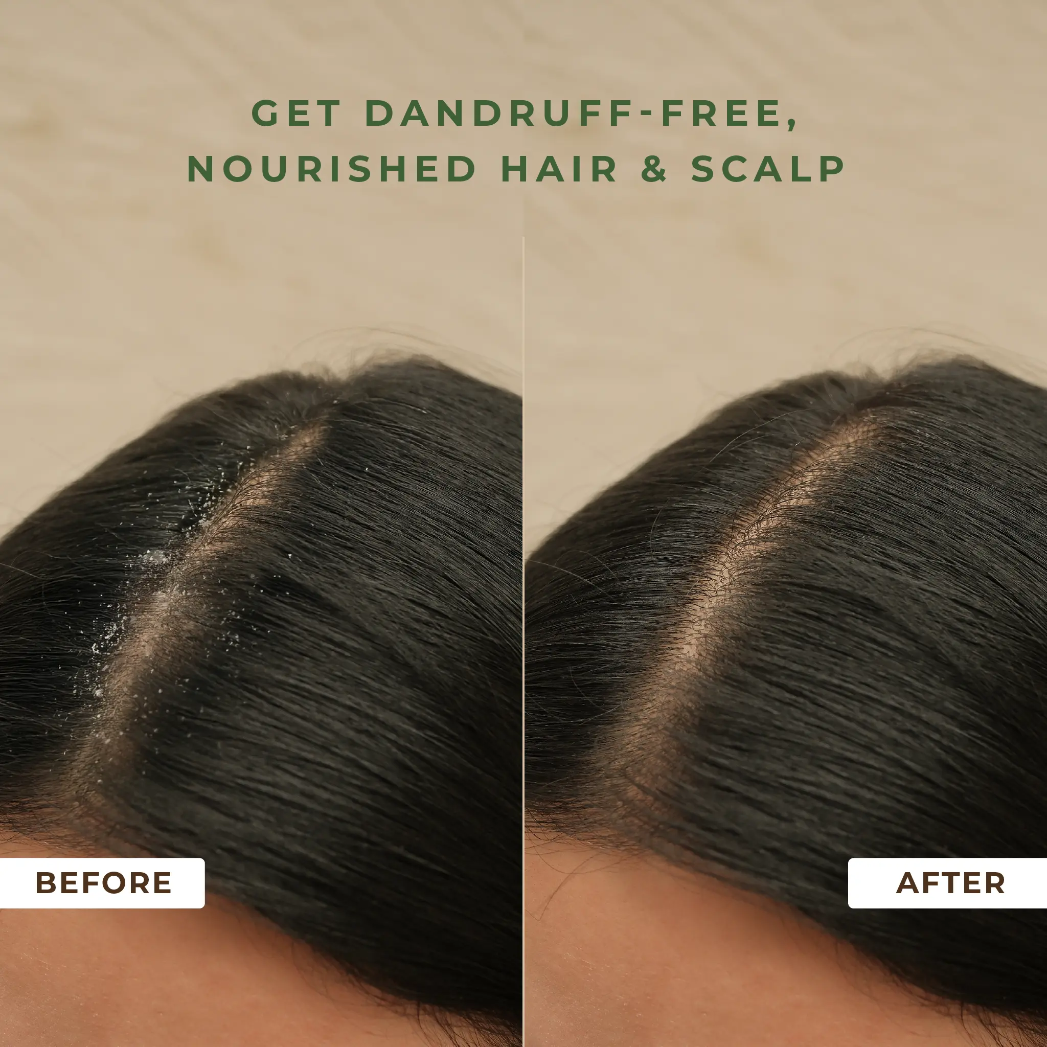 Naturali Anti-Dandruff Hair Mask With Hemp, Sage & Salicylic Acid - Image 6