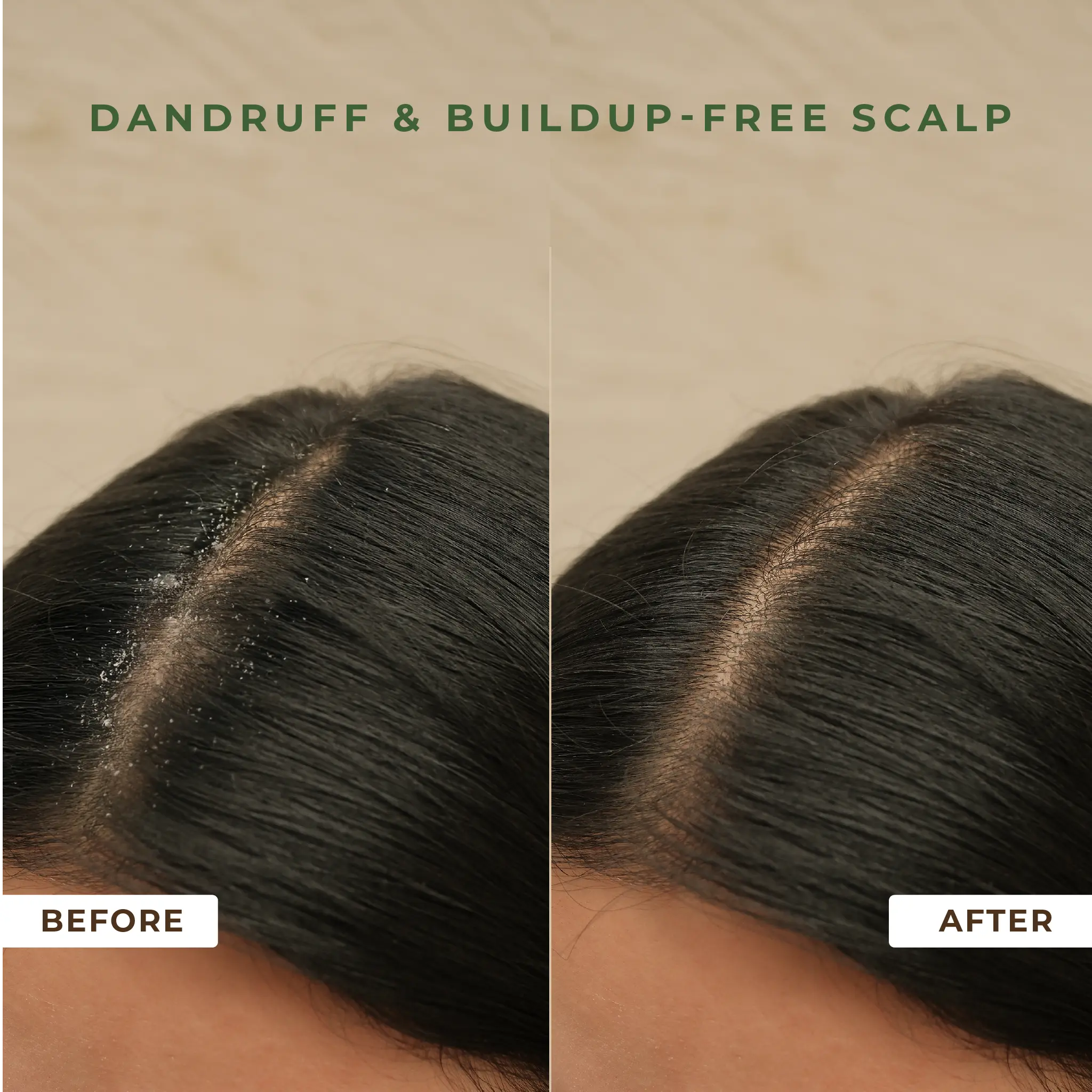 Naturali Anti-Dandruff Shampoo + Conditioner + Scalp Serum - Image 6