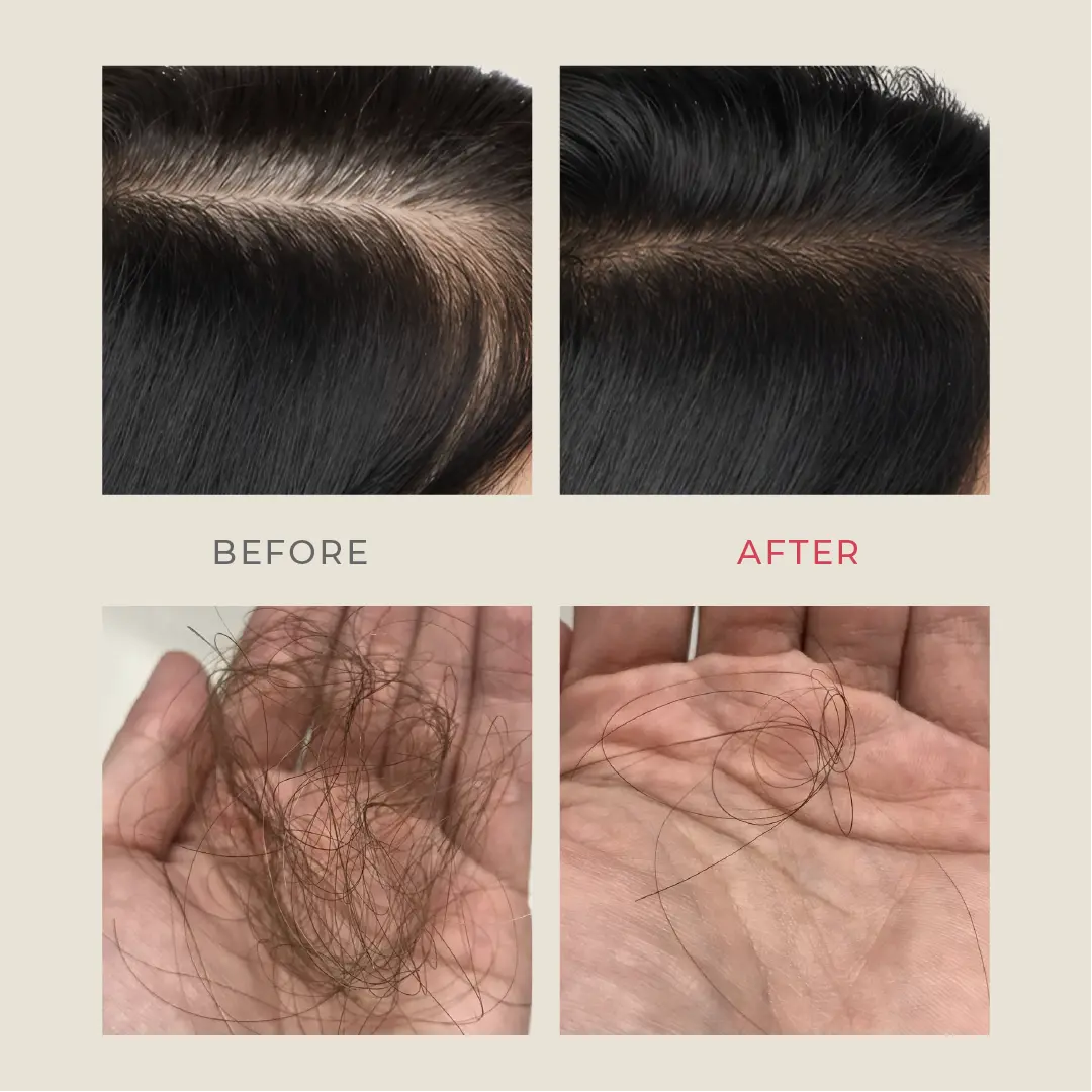 Naturali Hair Fall Arrest Shampoo with Onion and Bhringraj - Image 3